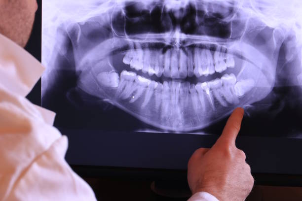 Best Cracked Tooth Emergency Dentist  in Barnesville, GA